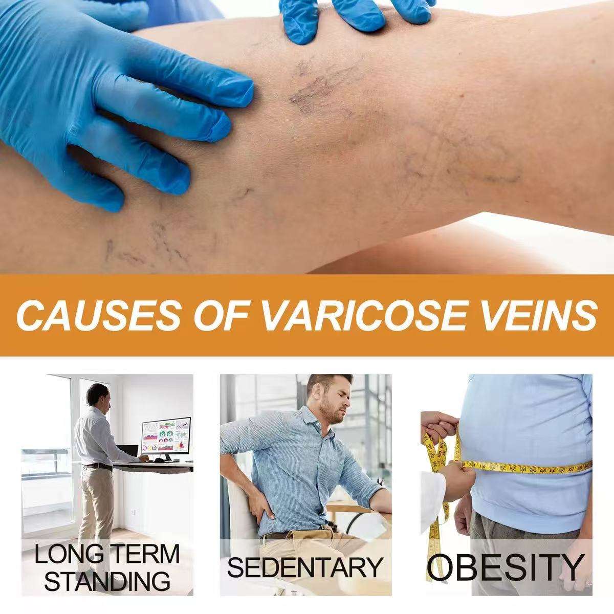 Varicose Veins Health Care Paste
